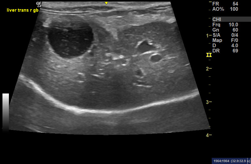 ultrasound 01
