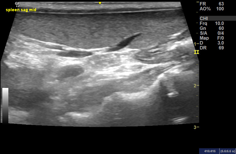 ultrasound 02