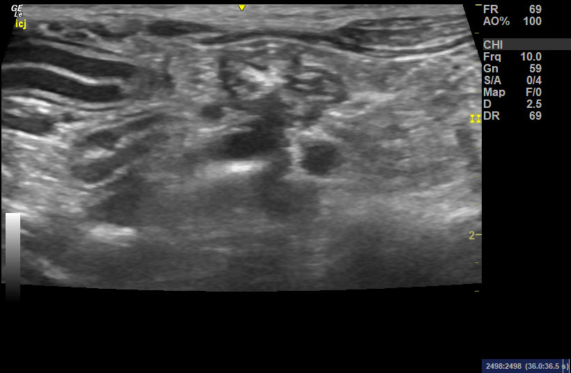 ultrasound 03